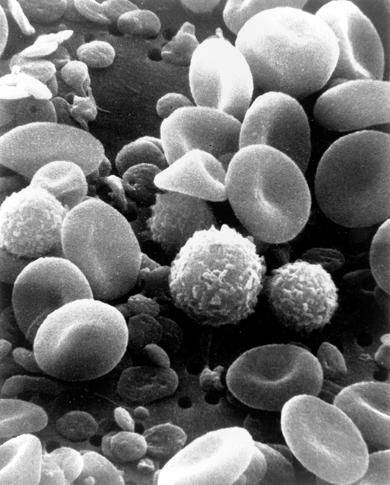 Scanning electron micrograph of blood cells